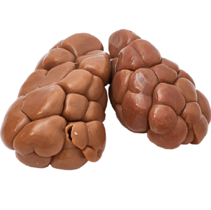 Achuras